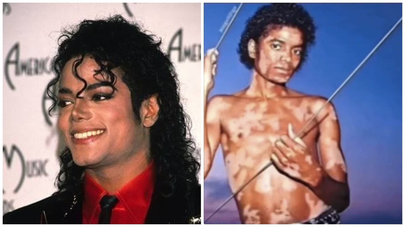 Michael Jackson's Skin Depigmentation Picture is Edited - Fact ...